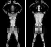 MIllimeter Wave Scan